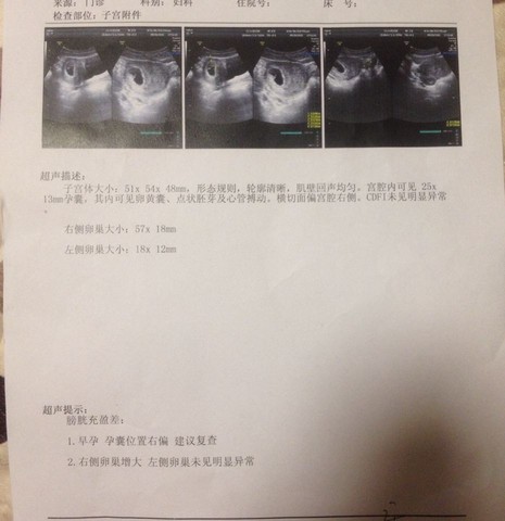 journal_insert_pic_306156546