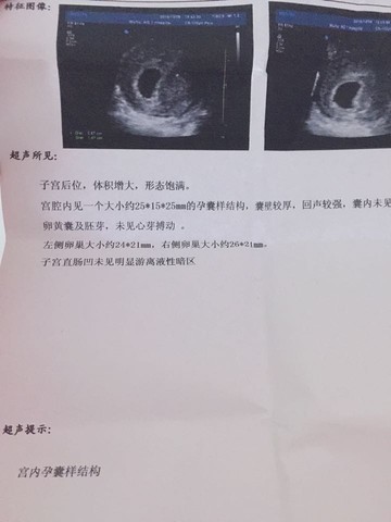 journal_insert_pic_310600171