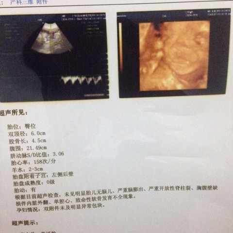 journal_insert_pic_310681254
