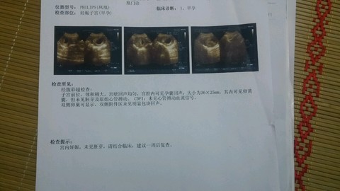 journal_insert_pic_311302087