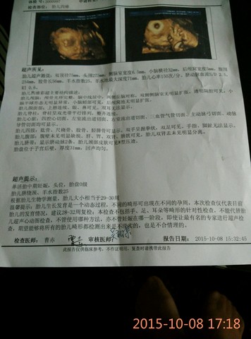 journal_insert_pic_312869179