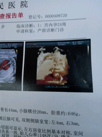journal_insert_pic_317070512
