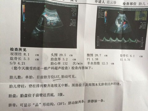 journal_insert_pic_320239869