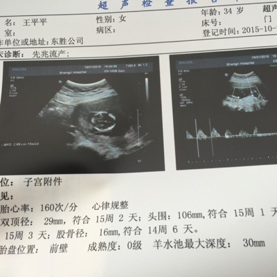 怀孕15周 3了突然出血 刚开始鲜红的后来暗红的 都两天多了还是有 但是去医院做b超检查孩子一切正常而且在里面很好 我现在卧床休息 这是怎么回事啊 宝宝树