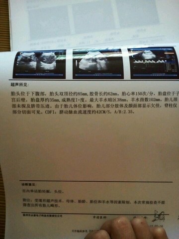 journal_insert_pic_323506438