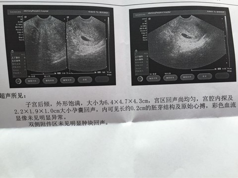 journal_insert_pic_325538746