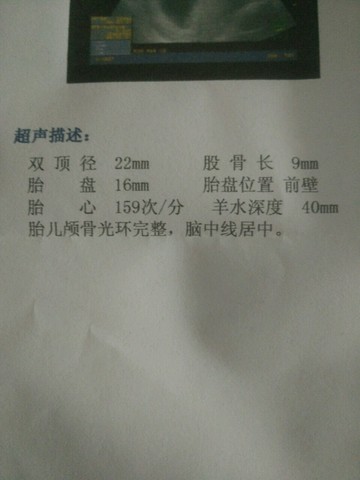 journal_insert_pic_326784507