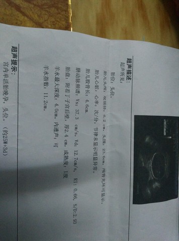 journal_insert_pic_328037230