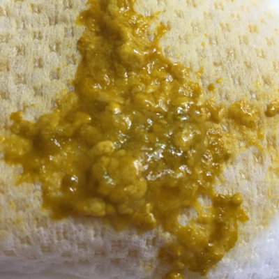 有点消化不良的感觉,查个常规排除一下展开阅读全文 大便