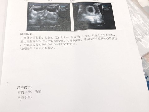 journal_insert_pic_334430634