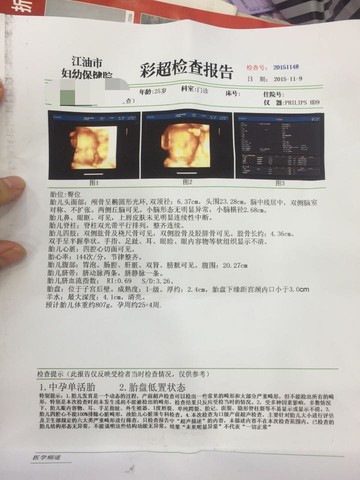 journal_insert_pic_335374101