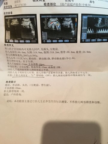 journal_insert_pic_338371270