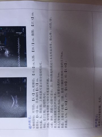 journal_insert_pic_340823205