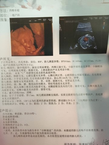journal_insert_pic_346049387