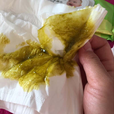 宝宝三个月了,母乳餵养,前几天拉黄色泡沫的屎,吃了两天妈咪爱,现在又