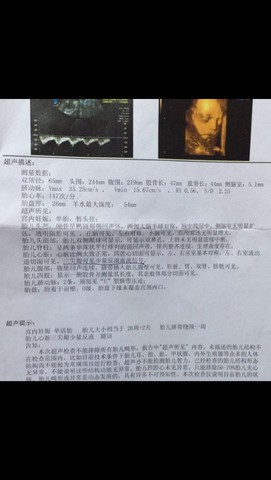 journal_insert_pic_354659878