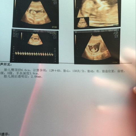 journal_insert_pic_356021883