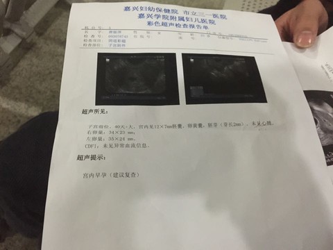 journal_insert_pic_357025065