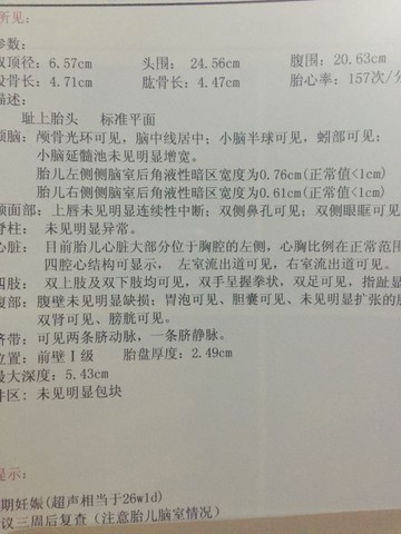 journal_insert_pic_358452092