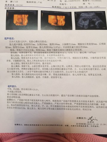 journal_insert_pic_374476647