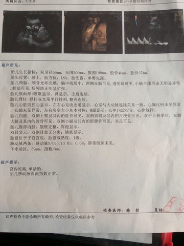 journal_insert_pic_375206017