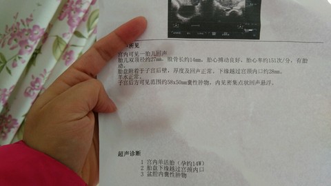 journal_insert_pic_376108848
