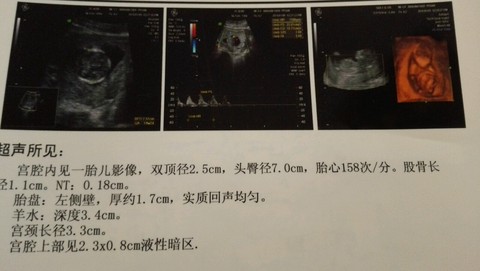journal_insert_pic_381397182