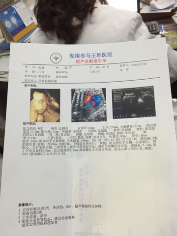 journal_insert_pic_382624019