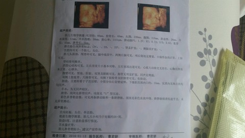 journal_insert_pic_386266543