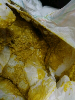 今天晚上宝宝拉屎有一粒粒的,有点带青,怎麼回事