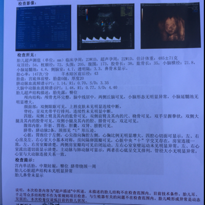 之前13周做nt 鼻骨可显示 现在23周做四维彩超 鼻骨未显示 是为什么 唐氏筛查低风险 宝宝树
