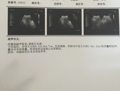 journal_insert_pic_395792202