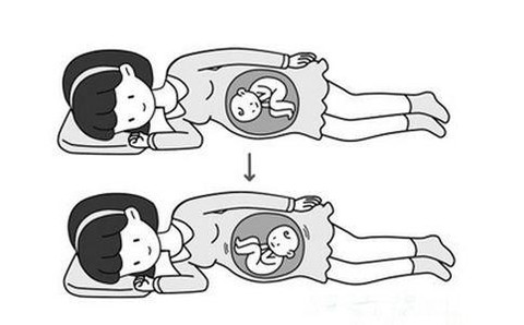 孕晚期胎儿姿势图图片