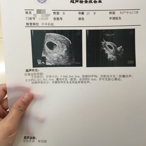 journal_insert_pic_400434578