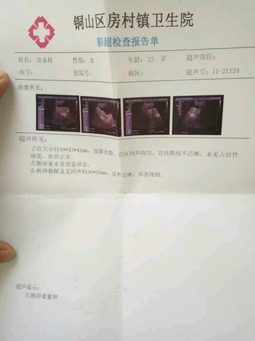 journal_insert_pic_402835258