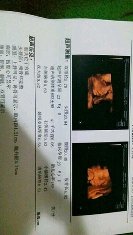 journal_insert_pic_405937043