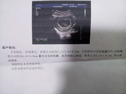 journal_insert_pic_411383828