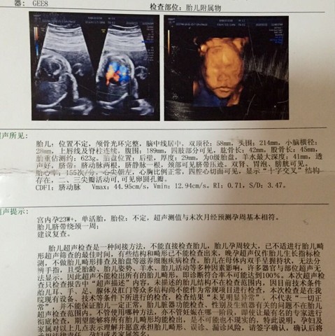 journal_insert_pic_412032807