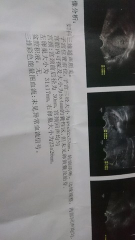 journal_insert_pic_413826522