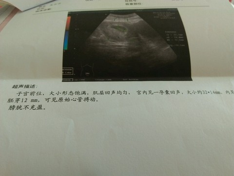 journal_insert_pic_414006857