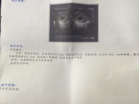 journal_insert_pic_414114517