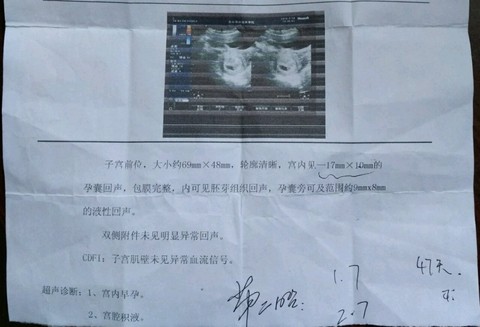 journal_insert_pic_416305217