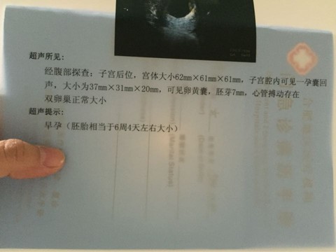journal_insert_pic_417801222