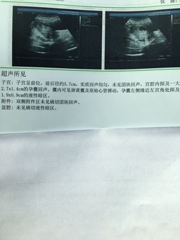 journal_insert_pic_417975162