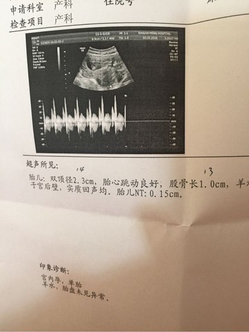 journal_insert_pic_418561554