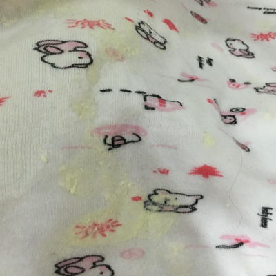 宝宝80天今天喷射状吐奶,成奶块状是怎麼了