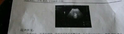 journal_insert_pic_428318605