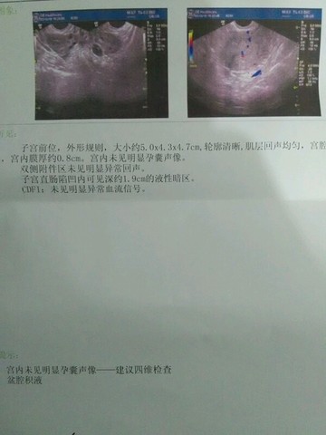 journal_insert_pic_429092856
