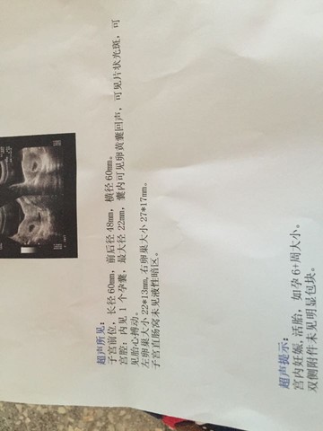 journal_insert_pic_428831037