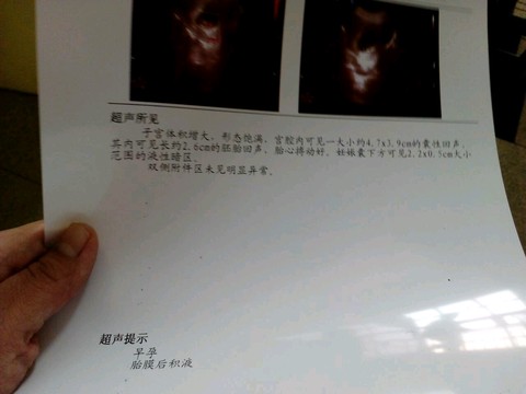 journal_insert_pic_429597803